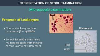 Interpretation of Stool Examination [upl. by Meuser]