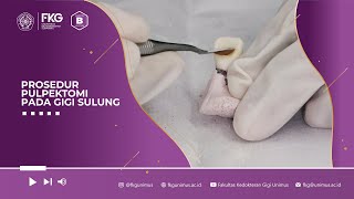 Prosedur PULPEKTOMI Pada Gigi Sulung [upl. by Kjersti5]