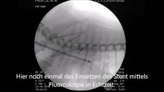 Trachealkollaps des Hundes  Diagnose amp Therapie [upl. by Anitsirhc459]