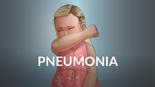 Pneumonia by B Fissel P Stoeck  OPENPediatrics [upl. by Rhianna38]