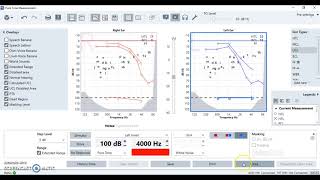 Hearing Test  Newborn Diagnostic Testing [upl. by Wynne]