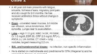 New and Emerging Treatments in Cutaneous Vasculitis [upl. by Phenica237]