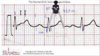 Interval Practice 65  ECG  EKG Interpretation  BASIC [upl. by Kirsch]