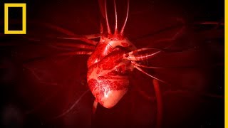 What is a coronary angiogram [upl. by Khichabia]