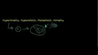 2  Introduction to pathology  hypertrophy hyperplasia [upl. by Nnaassilem569]