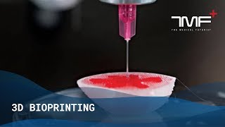 What Is 3D Bioprinting  The Medical Futurist [upl. by Nonnek]