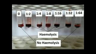 How to Determine antibody titer [upl. by Chow875]