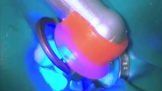 SmartLite Focus  Curing  Dentsply Sirona [upl. by Zerk]