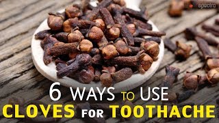 6 Ways to Use Cloves for Toothache [upl. by Edualcnaej]