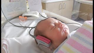 Hearing screening in NICU [upl. by Ulrich]