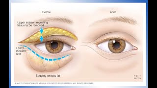 Ask the Eczperts How do you treat eyelid eczema [upl. by Hsakaa152]