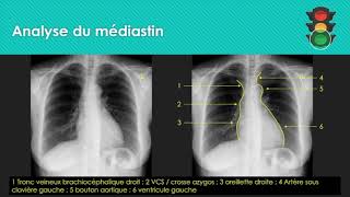 M2 Analyse de la radiographie thoracique parenchyme [upl. by Ahsuatan]