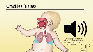 Respiratory Assessment by B Leary L DelSignore  OPENPediatrics [upl. by Kancler]