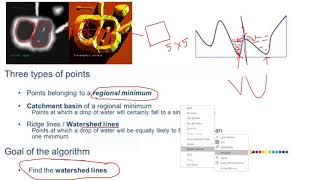 Watershed Segmentation Indepth Intuition  Digital Image Processing [upl. by Refanej]