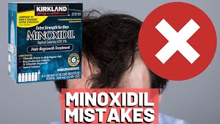 5 BIGGEST MISTAKES When Using Minoxidil REVEALED [upl. by Nesaj]