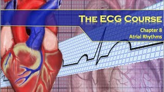 The ECG Course  Atrial Rhythms [upl. by Simon419]