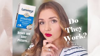 Lumineux Whitening Strips  Honest Review [upl. by Ynnaf111]