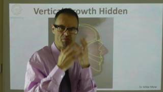 Hiding An Increase in Vertical Facial Growth By Dr Mike Mew [upl. by Nuaj818]