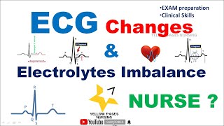 ECG changes in electrolyte imbalance [upl. by Gracye499]