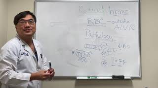 Retinal hemorrhages [upl. by Boylan]