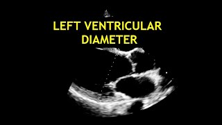 How to measure the LEFT VENTRICULAR DIAMETER Echocardiography [upl. by Ahto]