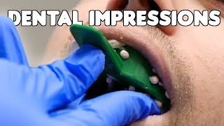 Dental Impressions amp Pouring Teeth Models [upl. by Adnaluy129]