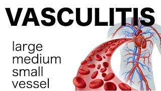 Vasculitis [upl. by Iad]