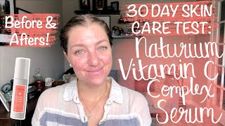 30 DAY SKIN CARE TEST NATURIUM VITAMIN C COMPLEX SERUM Before amp Afters Dry Acne Prone Skin [upl. by Nefets868]