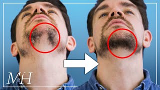 How To Fix Your Patchy Beard… Fast [upl. by Cherey]