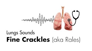 How to Use a Stethoscope to Identify Lung Sounds [upl. by Aikemaj]