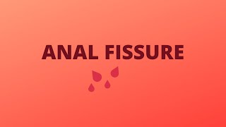 Anal Fissure  DefintionTypesCausesSigns amp SymptomsDiagnosisTreatment [upl. by Felisha154]