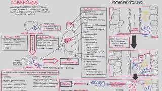 Liver Cirrhosis SandS Pathophysiology Investigations Management [upl. by Gaskins487]