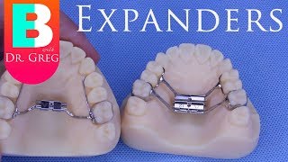 BRACES EXPLAINED Palatal Expanders [upl. by Frederico]