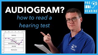 How to take a hearing test [upl. by Efram]