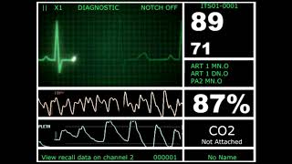 Hospital Monitor with FlatLine L HD [upl. by Beaston936]