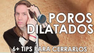 POROS DILATADOS  Como mejorarlos [upl. by Etnoed]