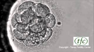 Human Embryo Growing from Fertilization to Day 6 Blastocyst [upl. by Rayna915]