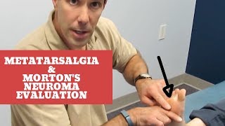 Metatarsalgia and Mortons Neuroma Evaluation and Treatment [upl. by Notelrac]