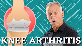 5 Proven Exercises for Knee Osteoarthritis or Knee Pain Do it Yourself [upl. by Villada]