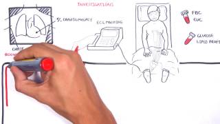 Acute Coronary Syndrome DETAILED Overview MI STEMI NSTEMI [upl. by Ninnette]