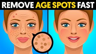 The quickest way to remove age spots [upl. by Raamaj519]