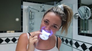 Do athome teeth whitening kits really work  Glam Lab [upl. by Otiragram409]