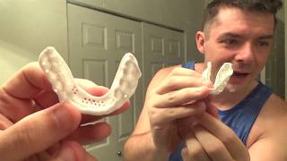 Sisu Mouthguard Molding and Review [upl. by Anilrahc]