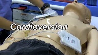 Implantable CardioverterDefibrillator ICD  CHI Health Clinic [upl. by Garret]