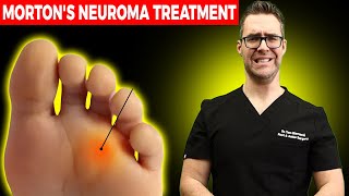 11 BEST Mortons Neuroma Massage Exercise amp Stretch Treatments WOW [upl. by Neeluqcaj]