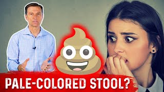 What Does PaleColored Poop Mean – DrBerg [upl. by Ativoj]