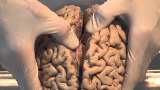 Introduction Neuroanatomy Video Lab  Brain Dissections [upl. by Ativet436]