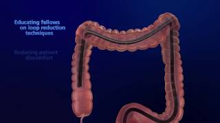 MiralaxDulcolax Colonoscopy Prep Instruction [upl. by Lenroc410]