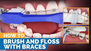 How to Brush amp Floss with Braces [upl. by Ayojal]