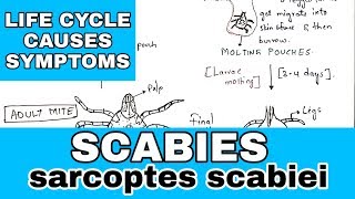 Scabies  sarcoptes scabiei  Life cycle causes symptoms  Bio science [upl. by Batish]